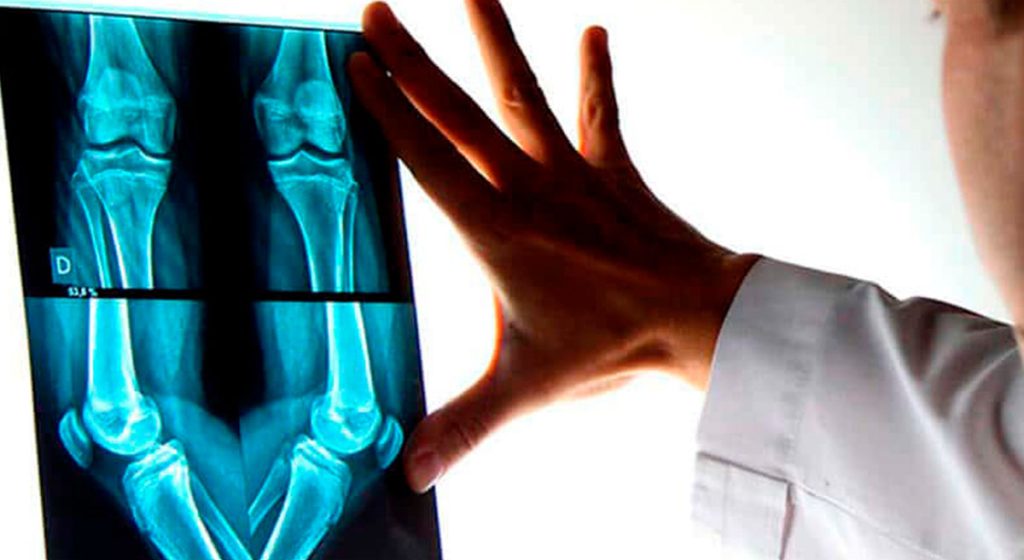 TRAUMATOLOGÍA